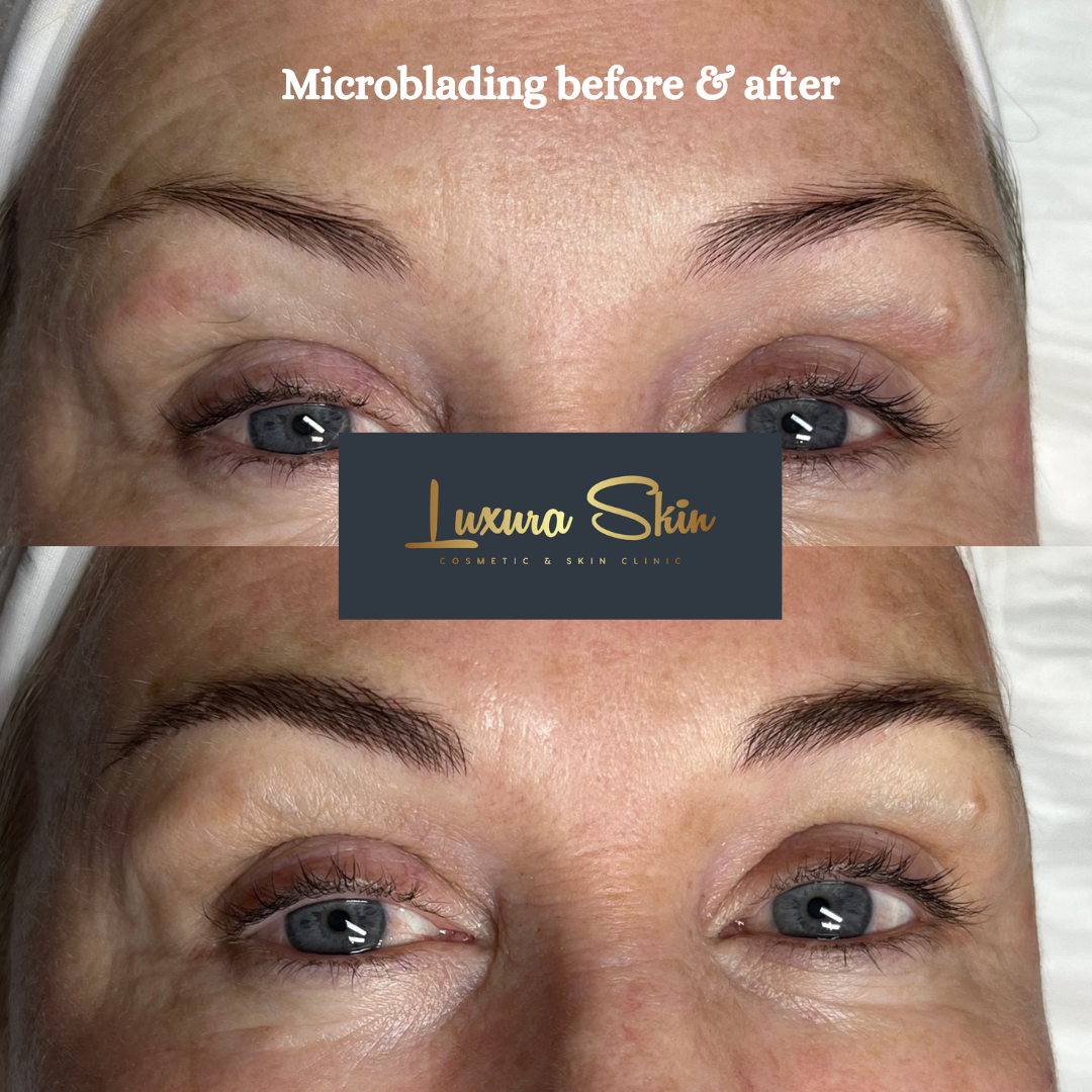 Cosmetic Tattooing