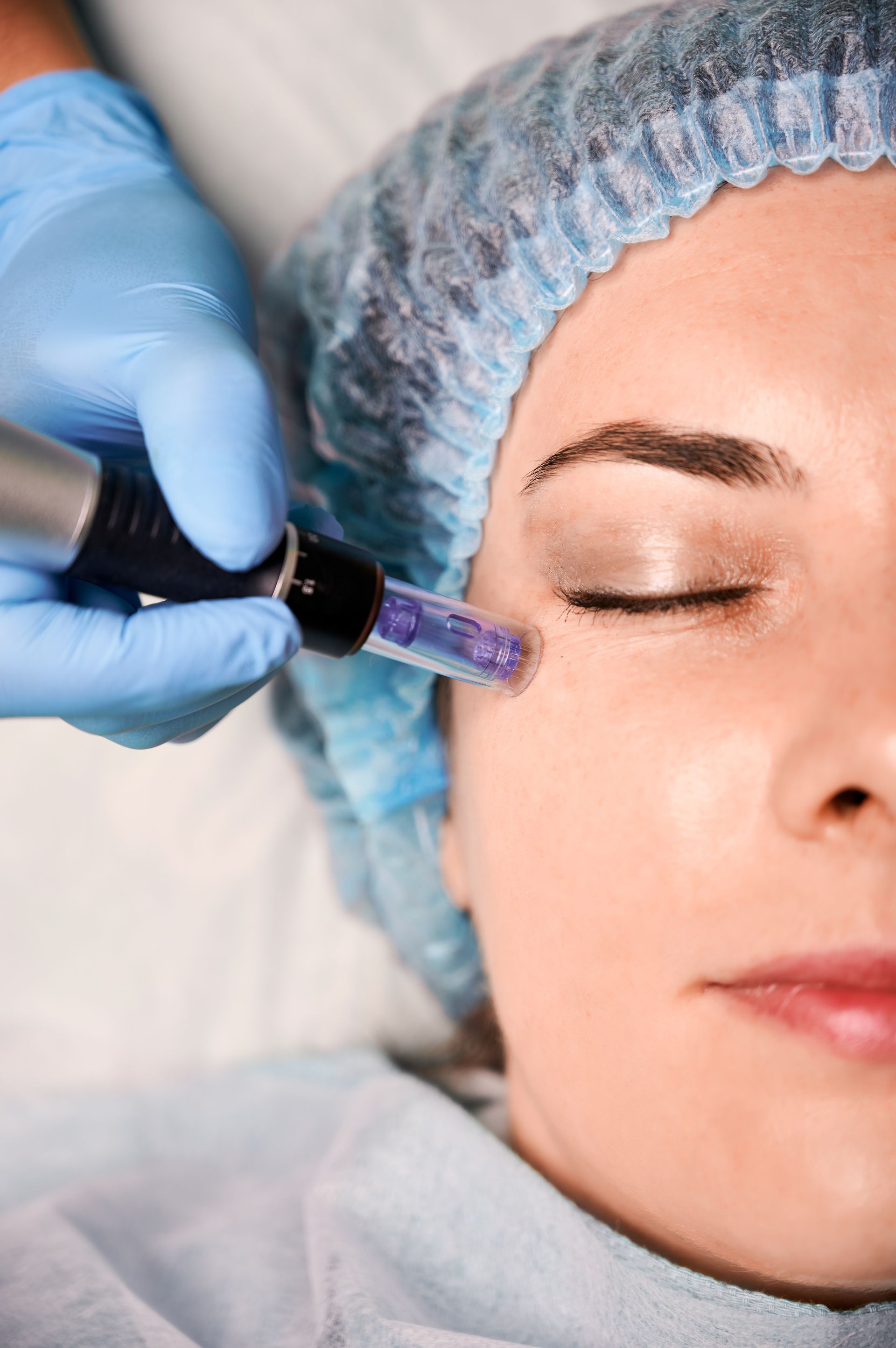 A gloved hand injects a woman’s cheek with a syringe in a clinical setting