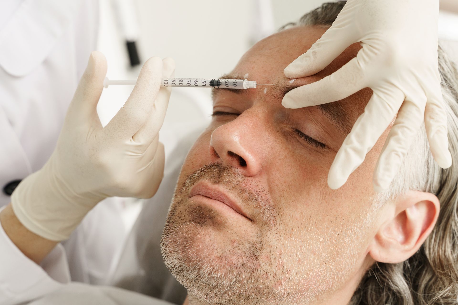 Gloved hands inject Botox into a man’s forehead as he lies with eyes closed.