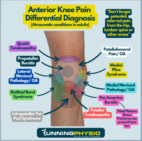 Illustrated knee pain diagram labeling common anterior knee pain causes and related structures.