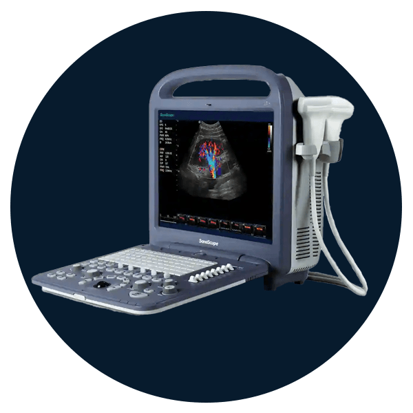 ecocardiograma hipertension