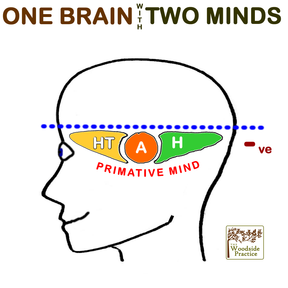 An image showing a simplified cross section of the brain with parts relevant to hypnotherapy with The Woodside Practice