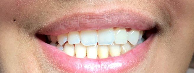 A close up of a woman 's mouth with white teeth and pink lips.