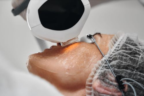 Laser device treating a patient's facial skin during a cosmetic procedure