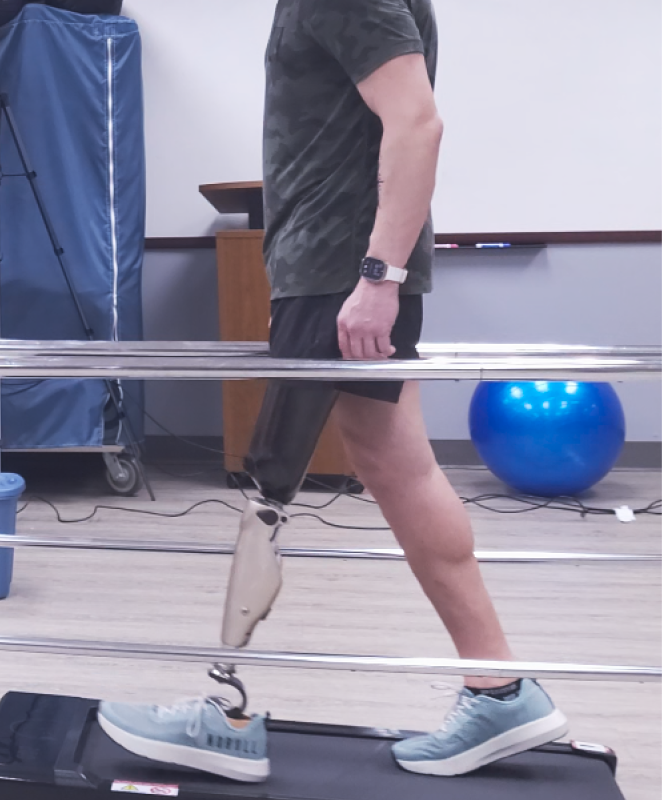 Person walking on a treadmill with a lower-leg prosthetic attached to the left leg