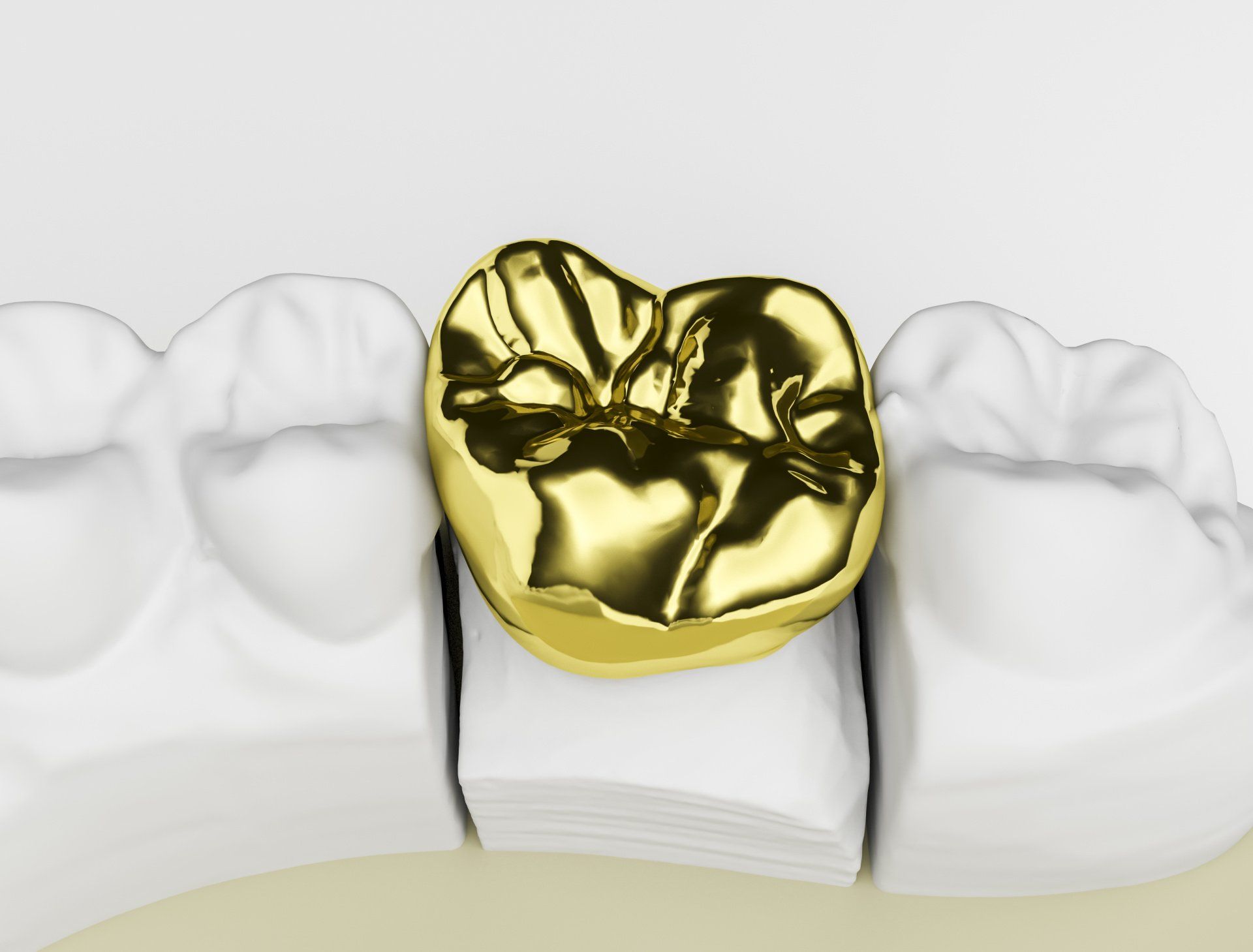 Full Cast Metal