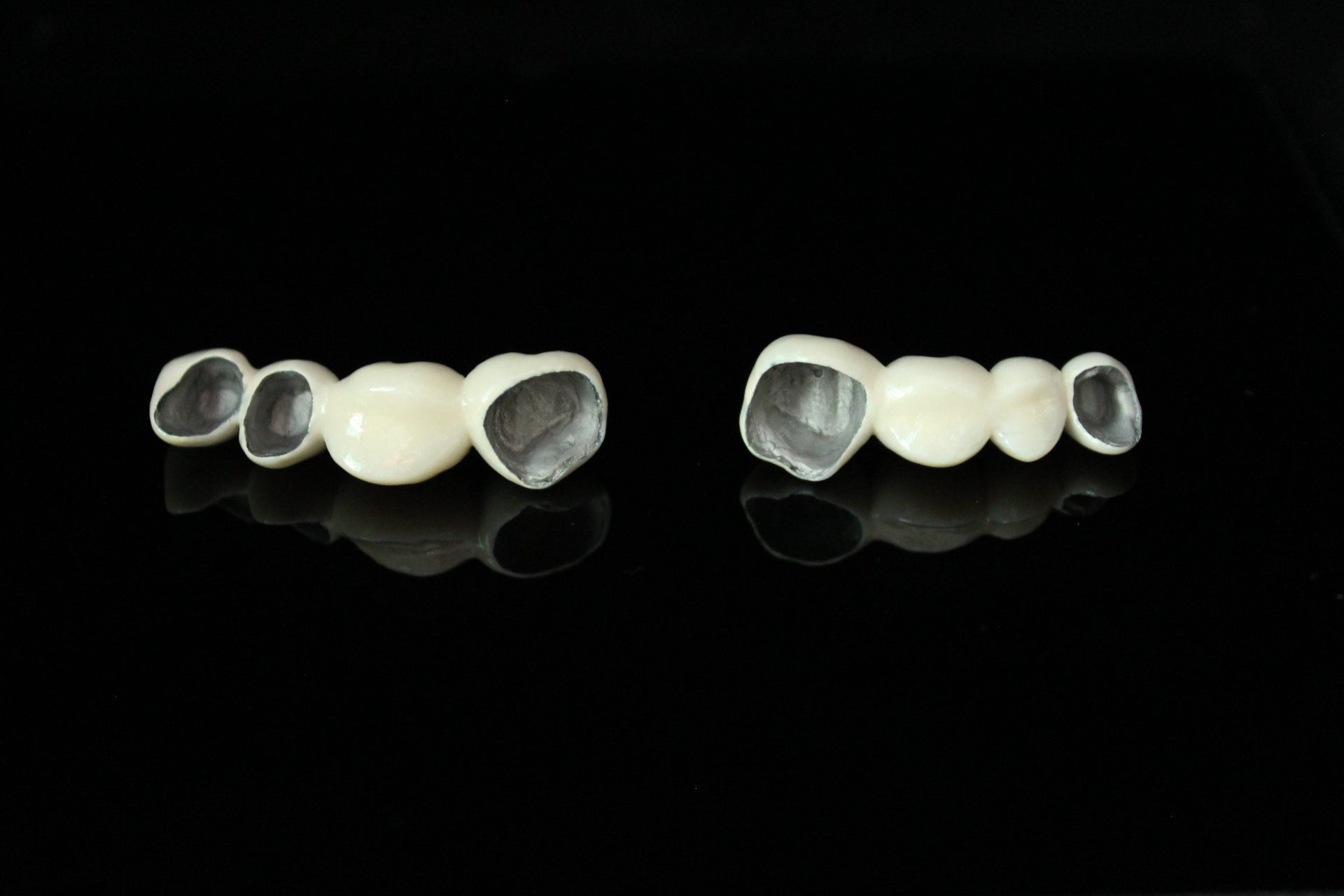 PFM Dental restorations
