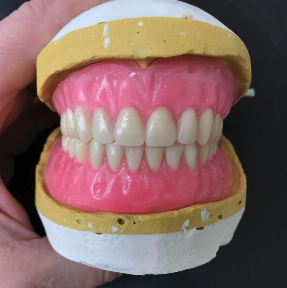 Dental labs in Westfield, MA 