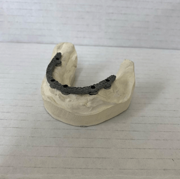 Dental labs in Westfield, MA 