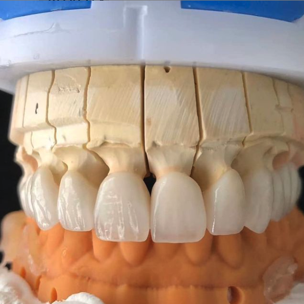 Dental labs in Westfield, MA 