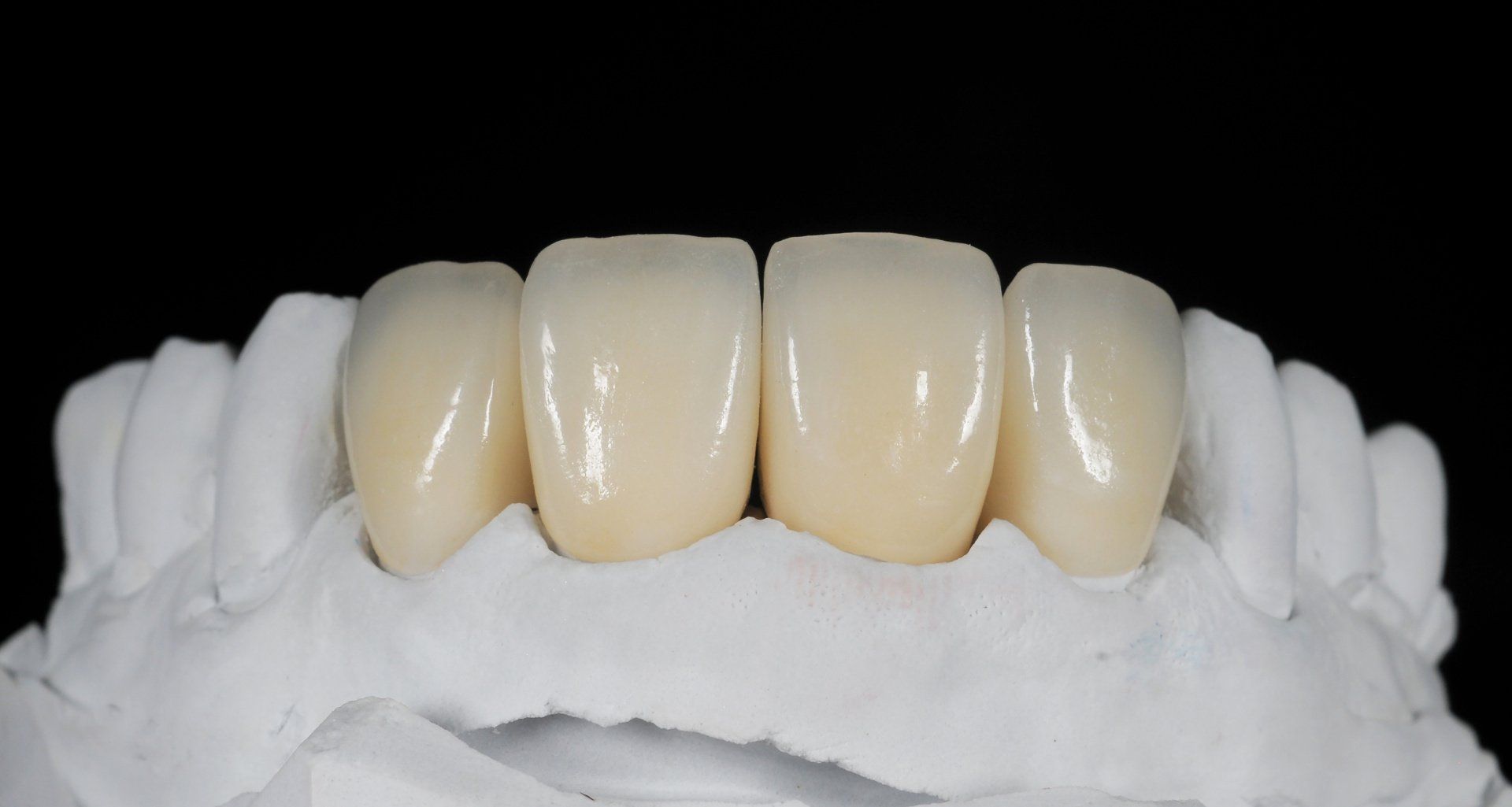 zirconia