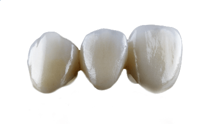 All-Ceramic