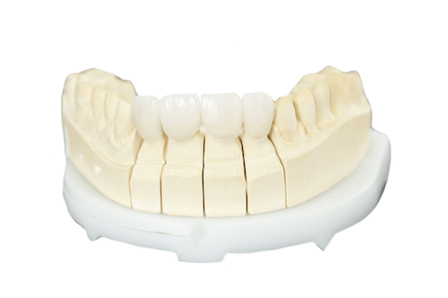 Fixed Restorations