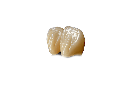 Full Contour Zirconia