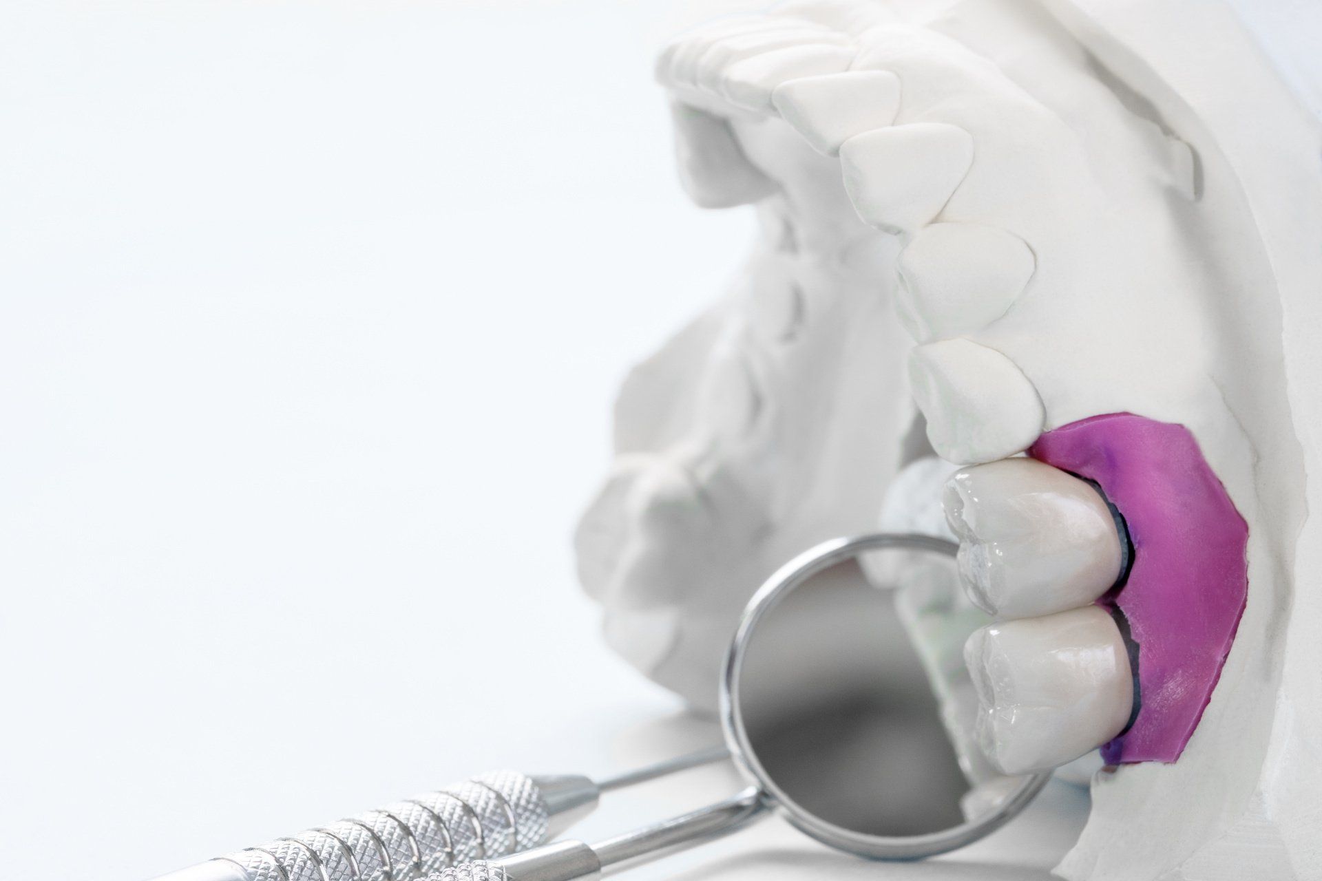 zirconia dental crowns