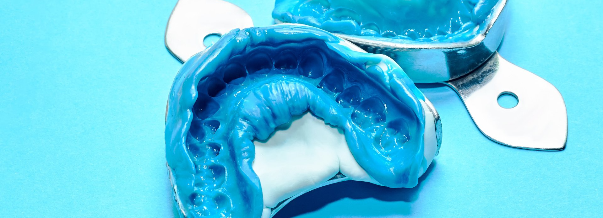 best dental impression materials you can use
