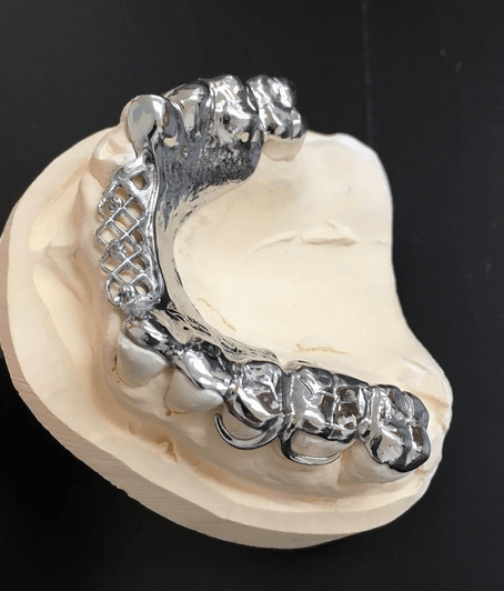 Dental labs in Westfield, MA 