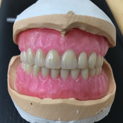Dental labs in Westfield, MA 