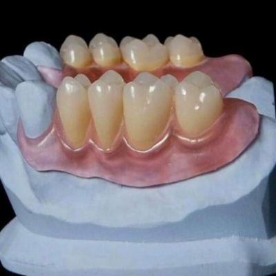 Dental labs in Westfield, MA 