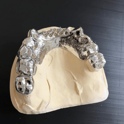 Dental labs in Westfield, MA 