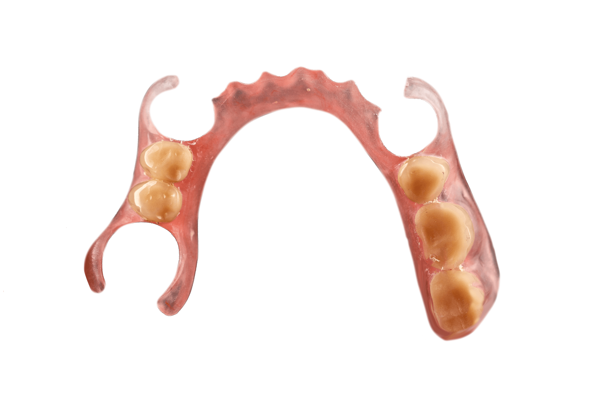 flexible partial dentures