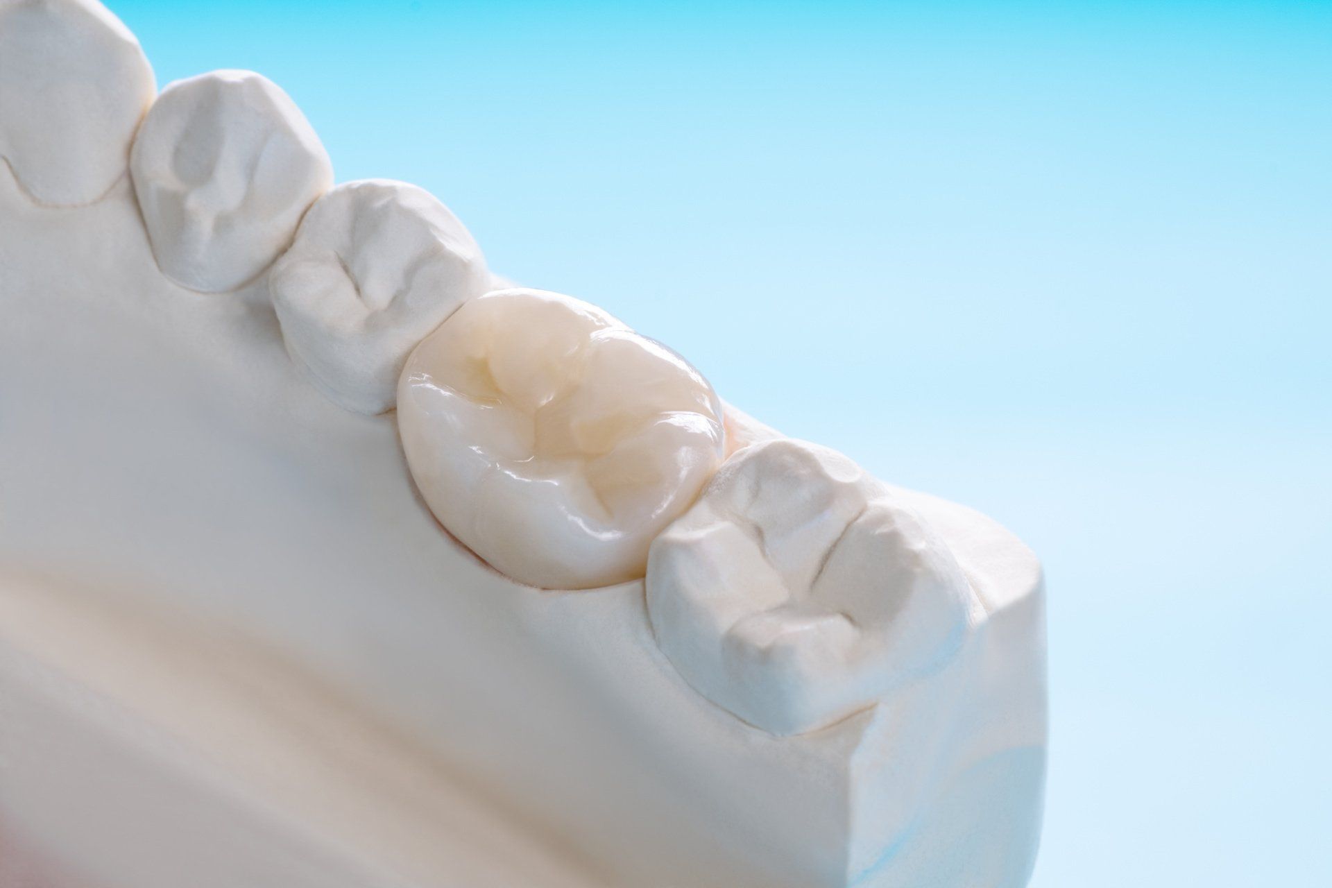 zirconia dental crowns