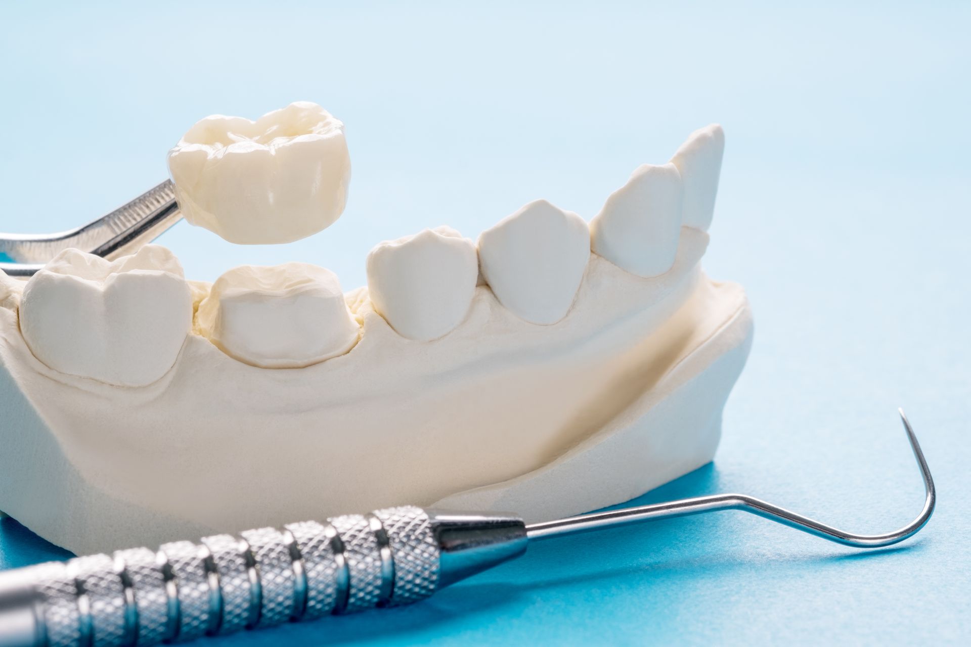 dental crowns, newton-le-willows, merseyside