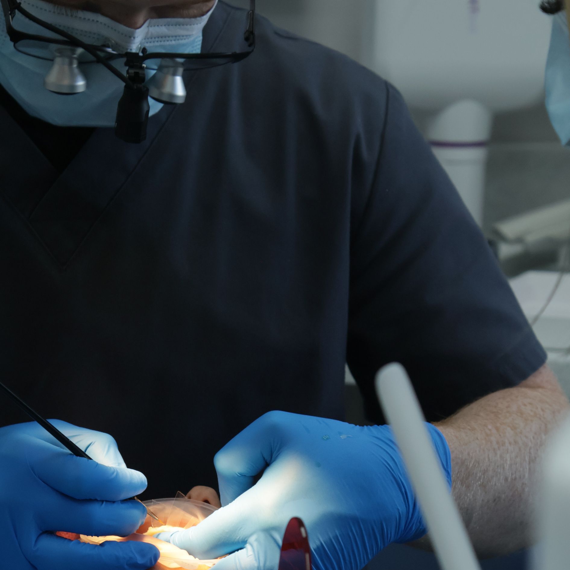 Composite bonding treatment at Newton Dental, Newton-le-Willows, merseyside.