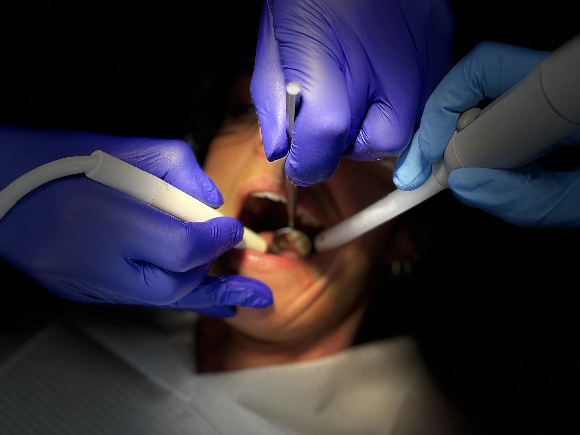 A dentist is examining a patient 's teeth, carrying out a scale and polish, maintaining oral health and oral hygiene