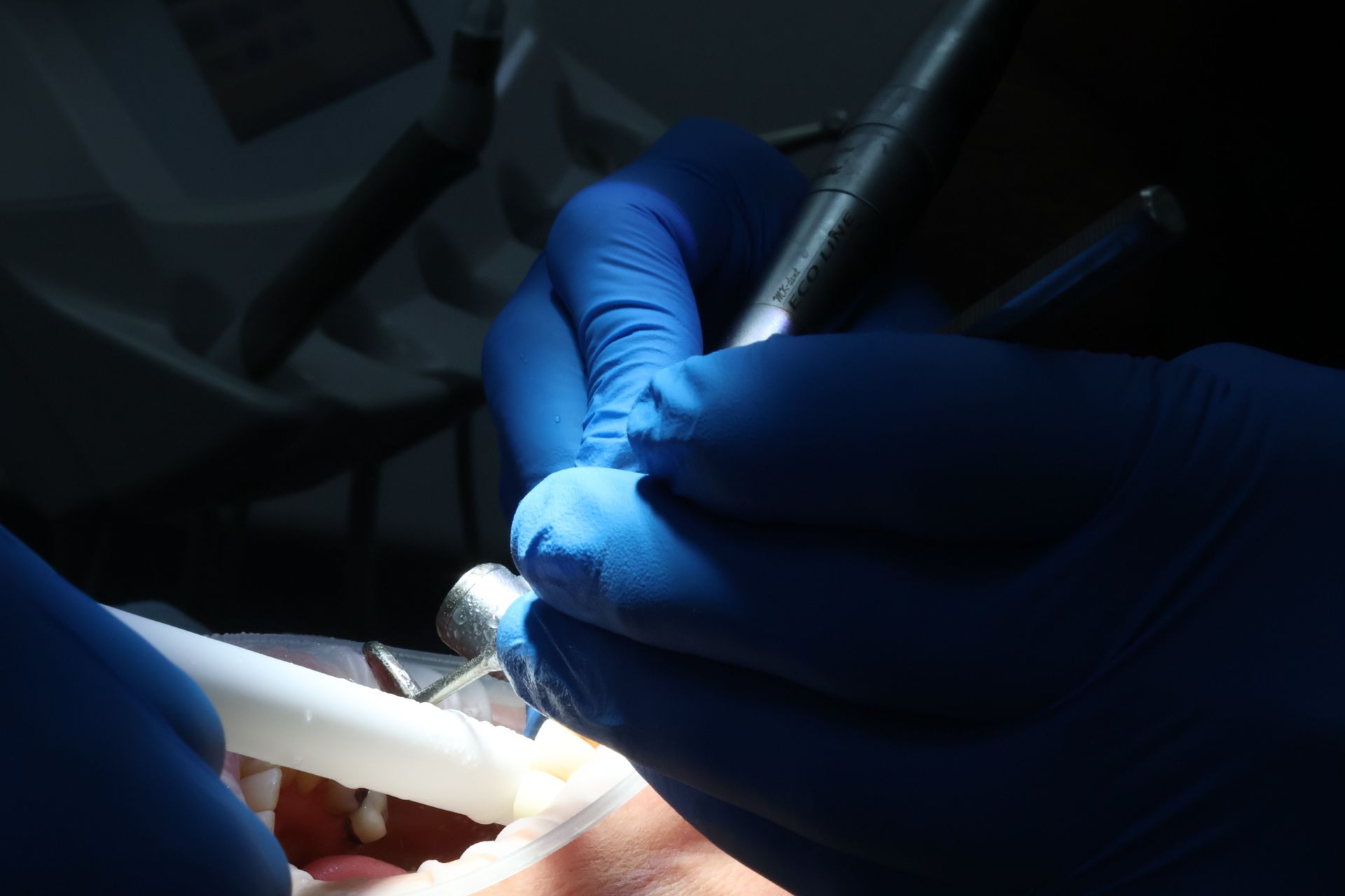 Family dentistry appointments at Newton Dental Merseyside