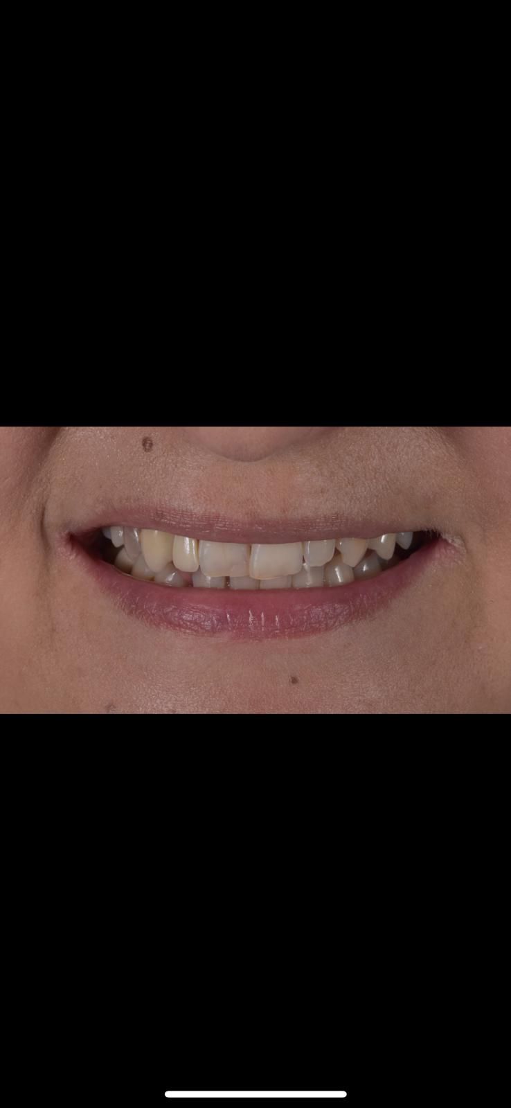 A close up of a woman 's smile with a black background.