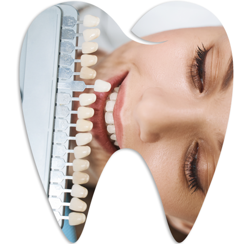 Cosmetic Dentistry — Kingston, NY — Kingston Dental Associates