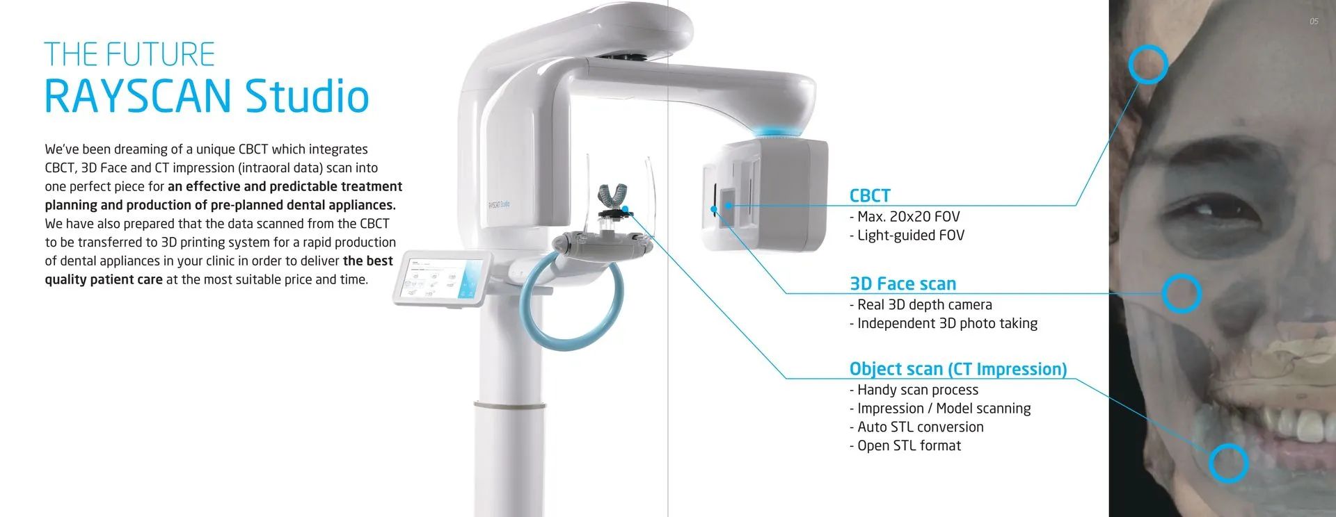 Teeth Scanner — Kingston, NY — Kingston Dental Associates

