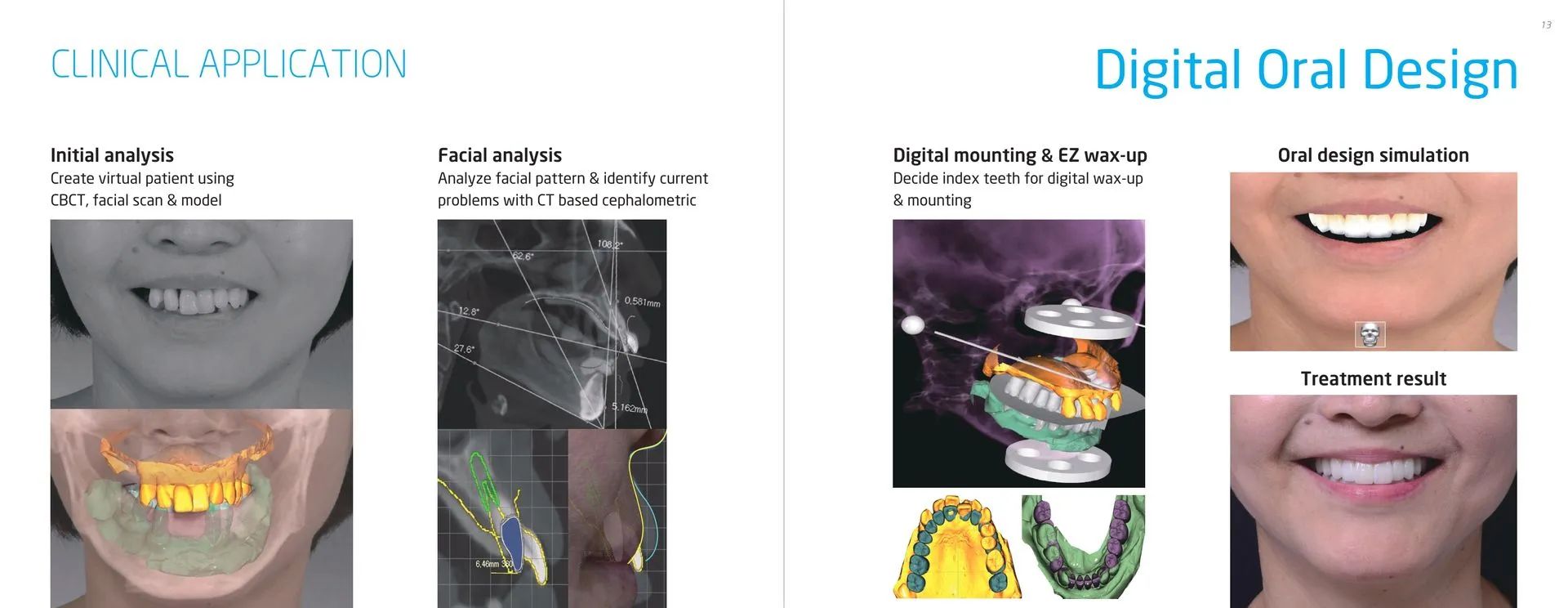 Digital Oral Design — Kingston, NY — Kingston Dental Associates
