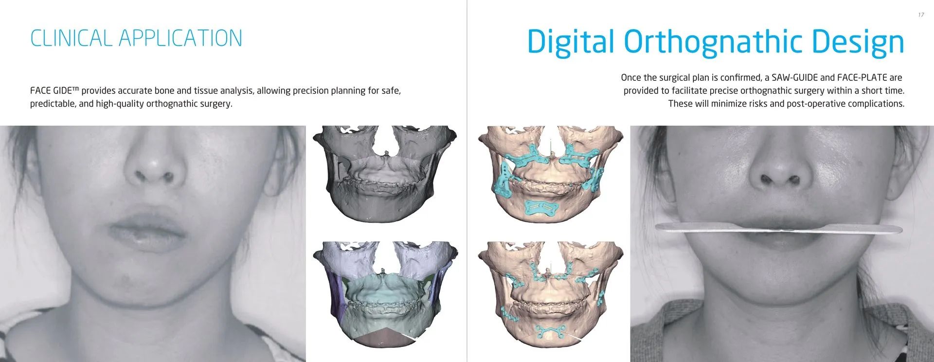 Mouth Scan — Kingston, NY — Kingston Dental Associates
