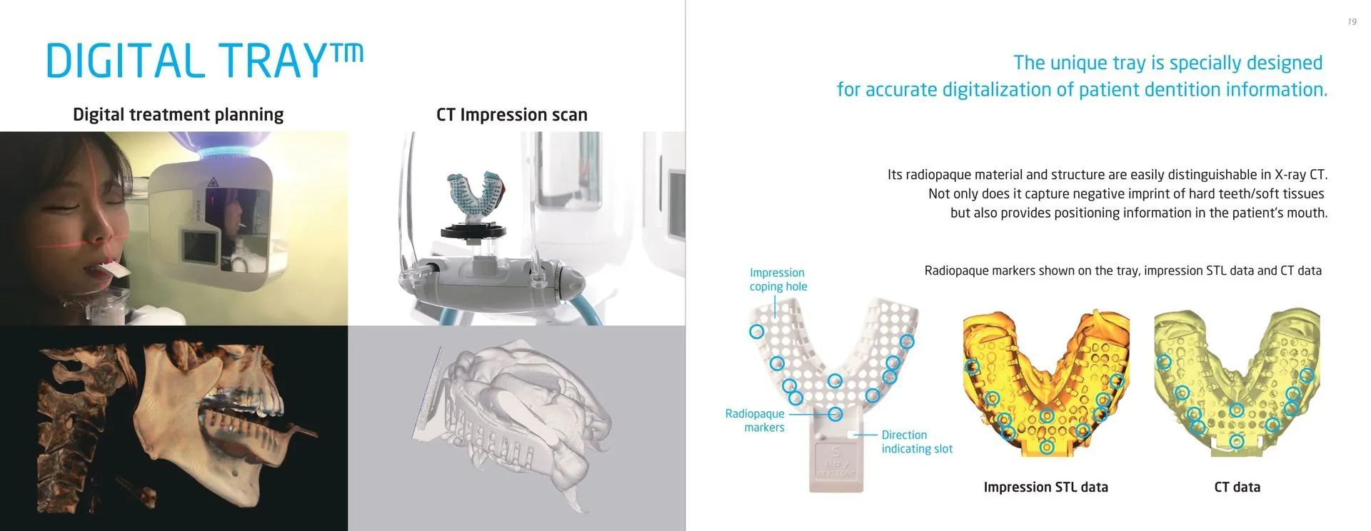 Teeth X-ray — Kingston, NY — Kingston Dental Associates
