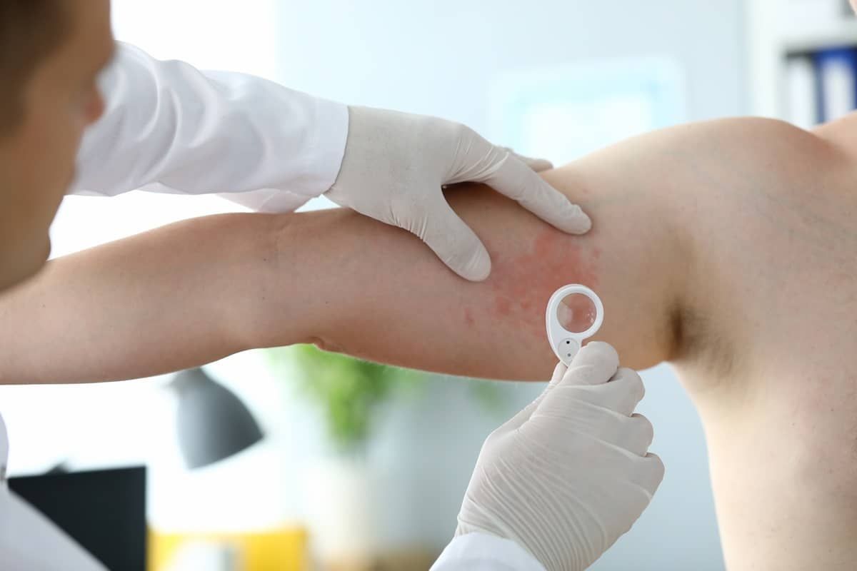 Treatment and Removal 3