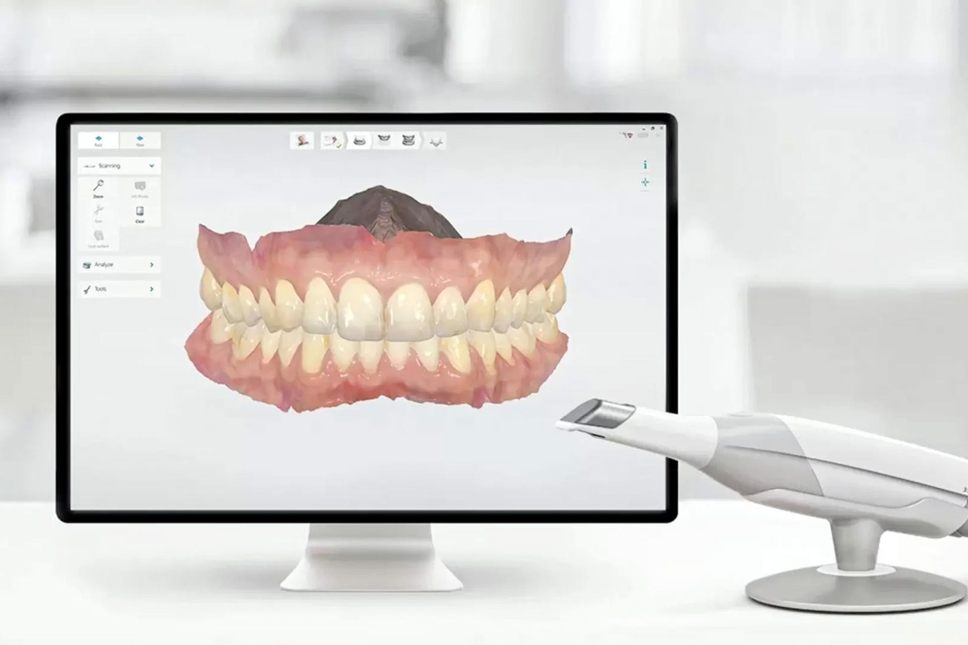 Impronta digitale