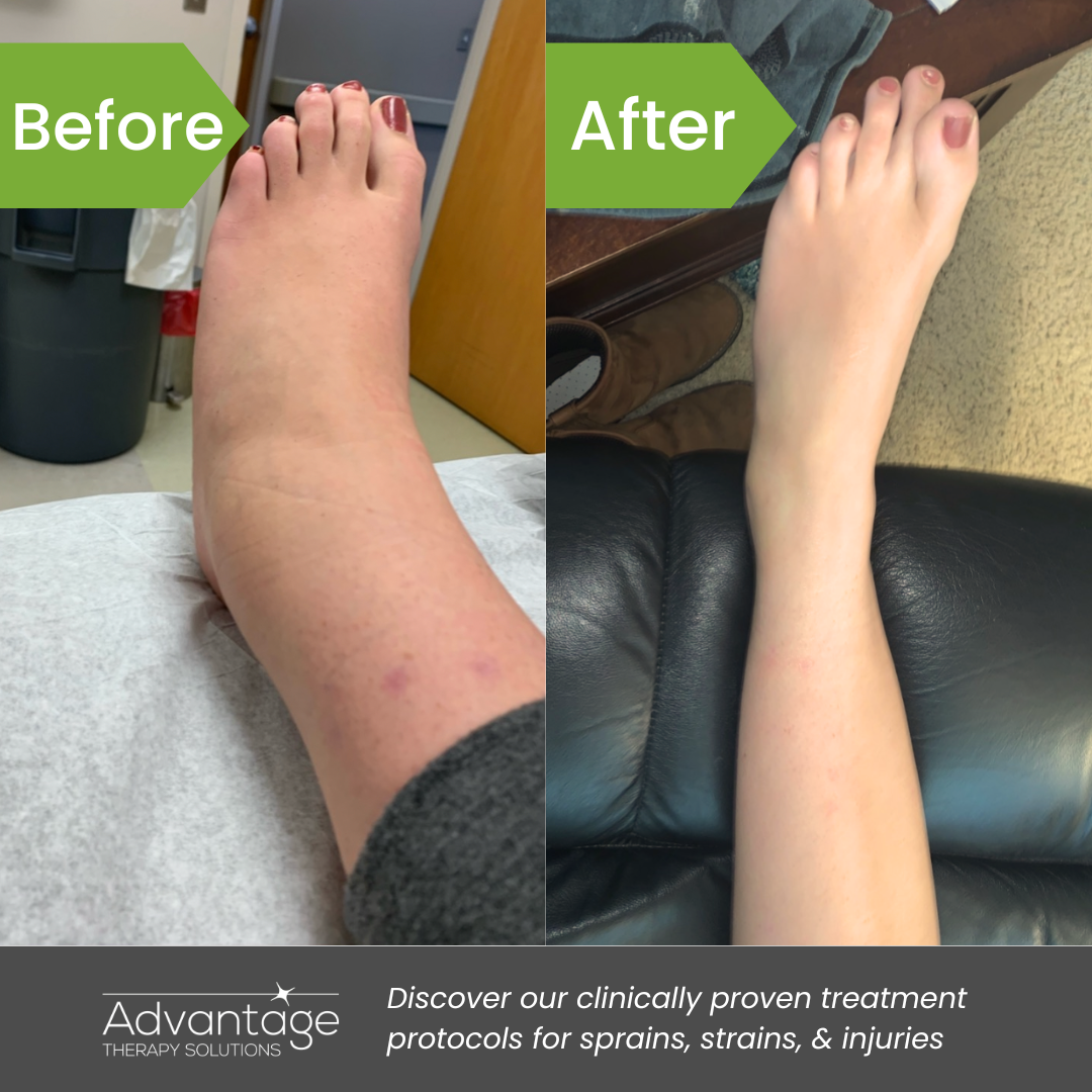 laser therapy for ankle swelling