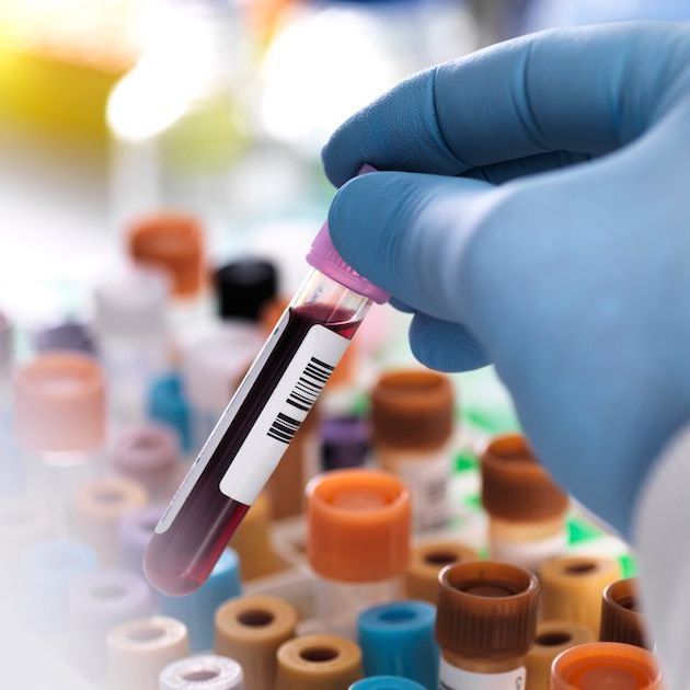 A hand in a blue glove is holding a test tube with a label that says negative