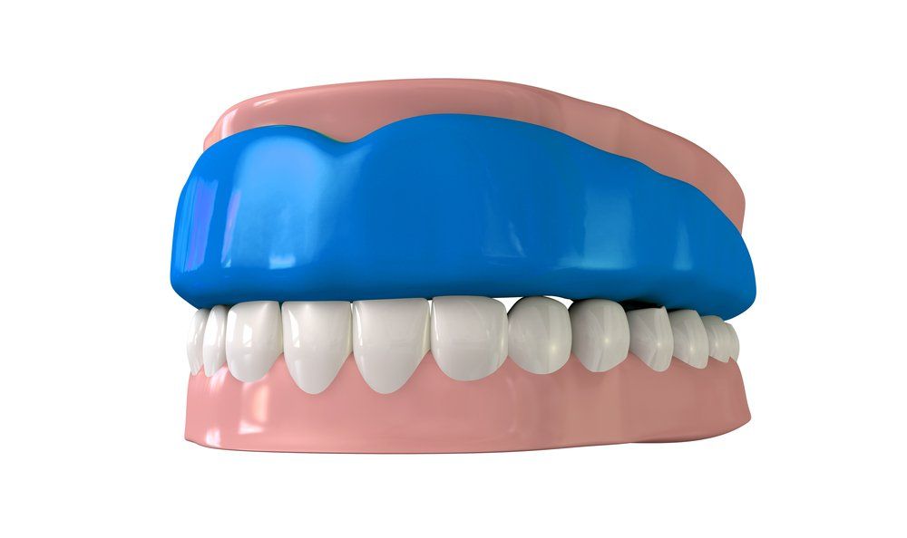 Dental Implant And Crowns On Table Dental Implant And Crowns On Table