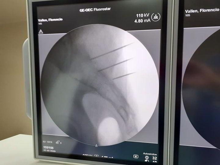 DRA. VERÓNICA ESPARZA CHONG - Terapia neural