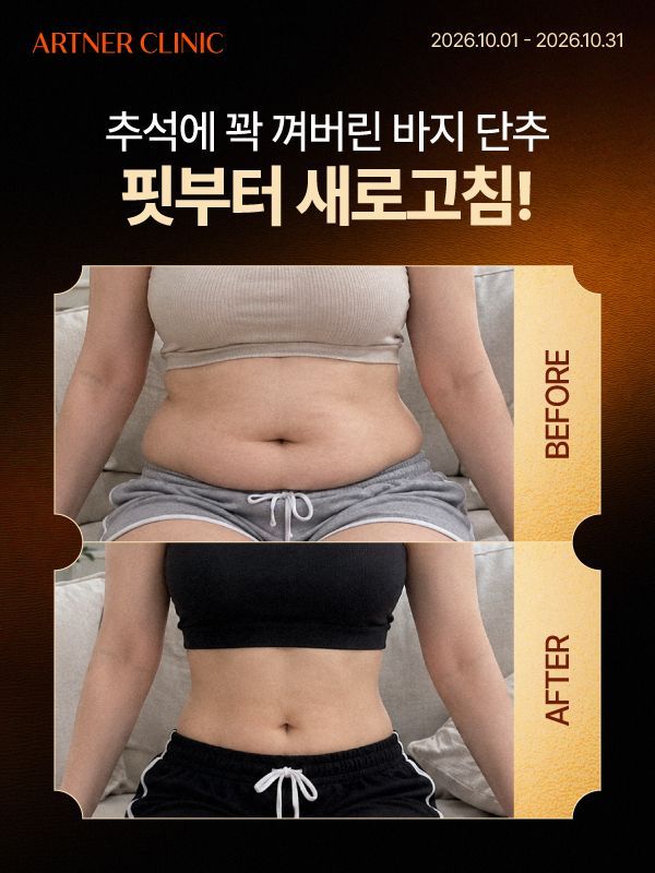 아트너의원 청담 이달의 프로모션 2