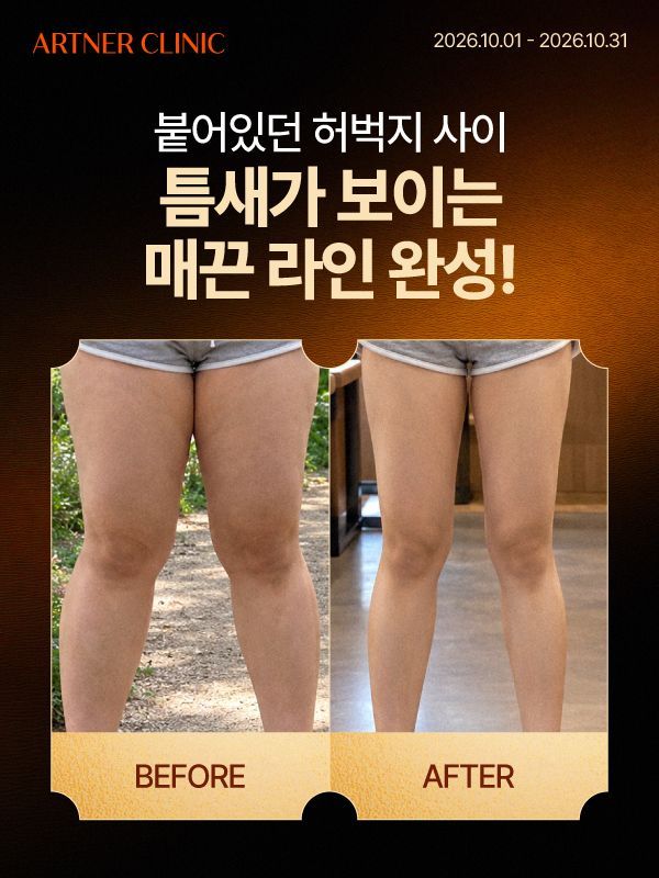 아트너의원 청담 이달의 프로모션 3