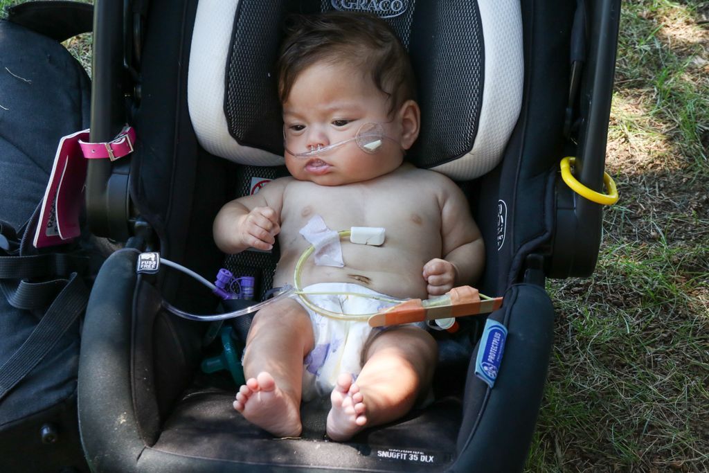 Baby in car seat with medical tubing and a pacifier, outdoors.