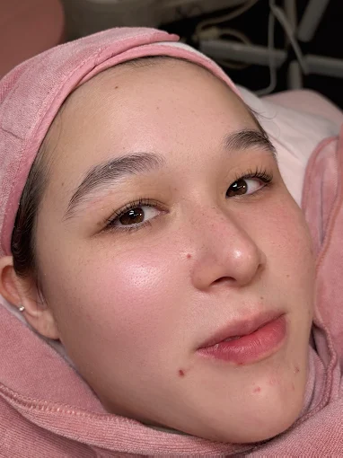 Close-up of a person wearing a pink headscarf, resting on a pillow with a calm expression.