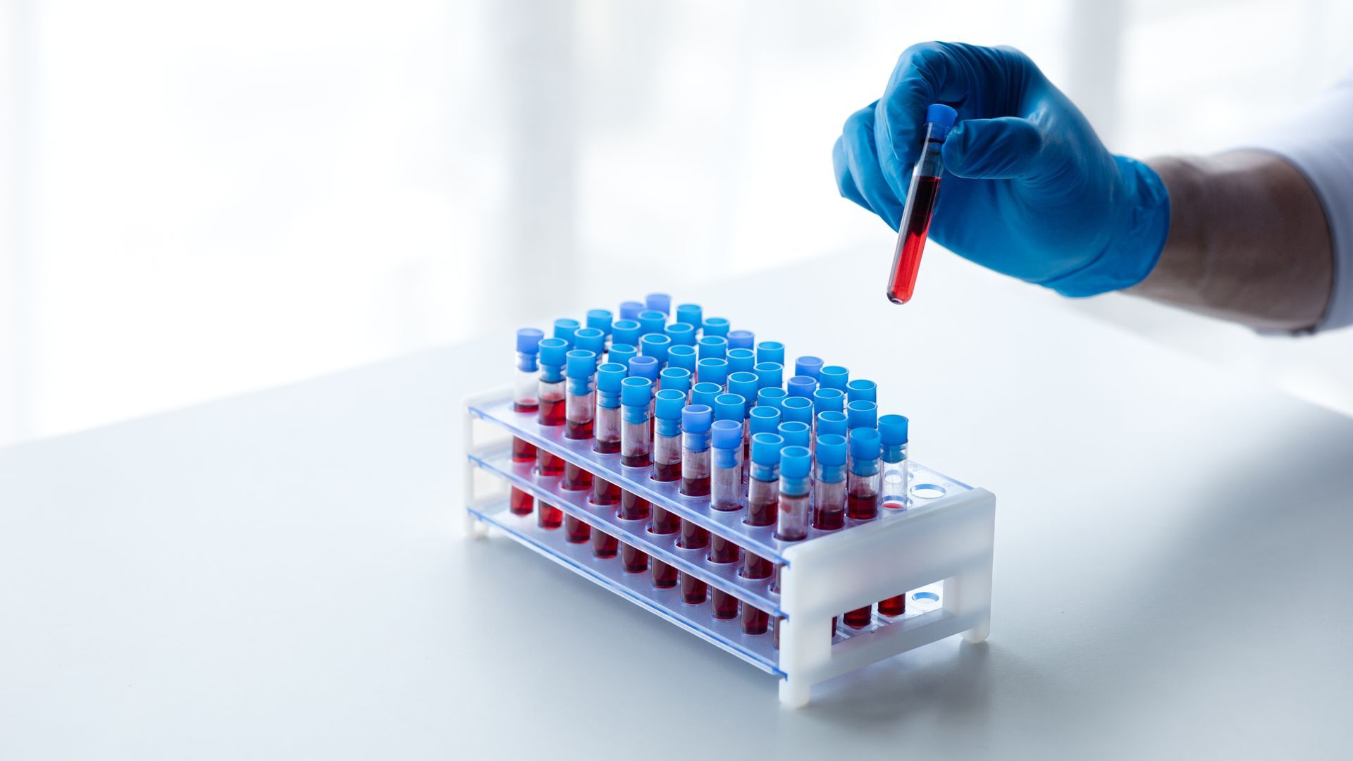 exame de sangue para intestino irritável exame de sangue para intestino irritável