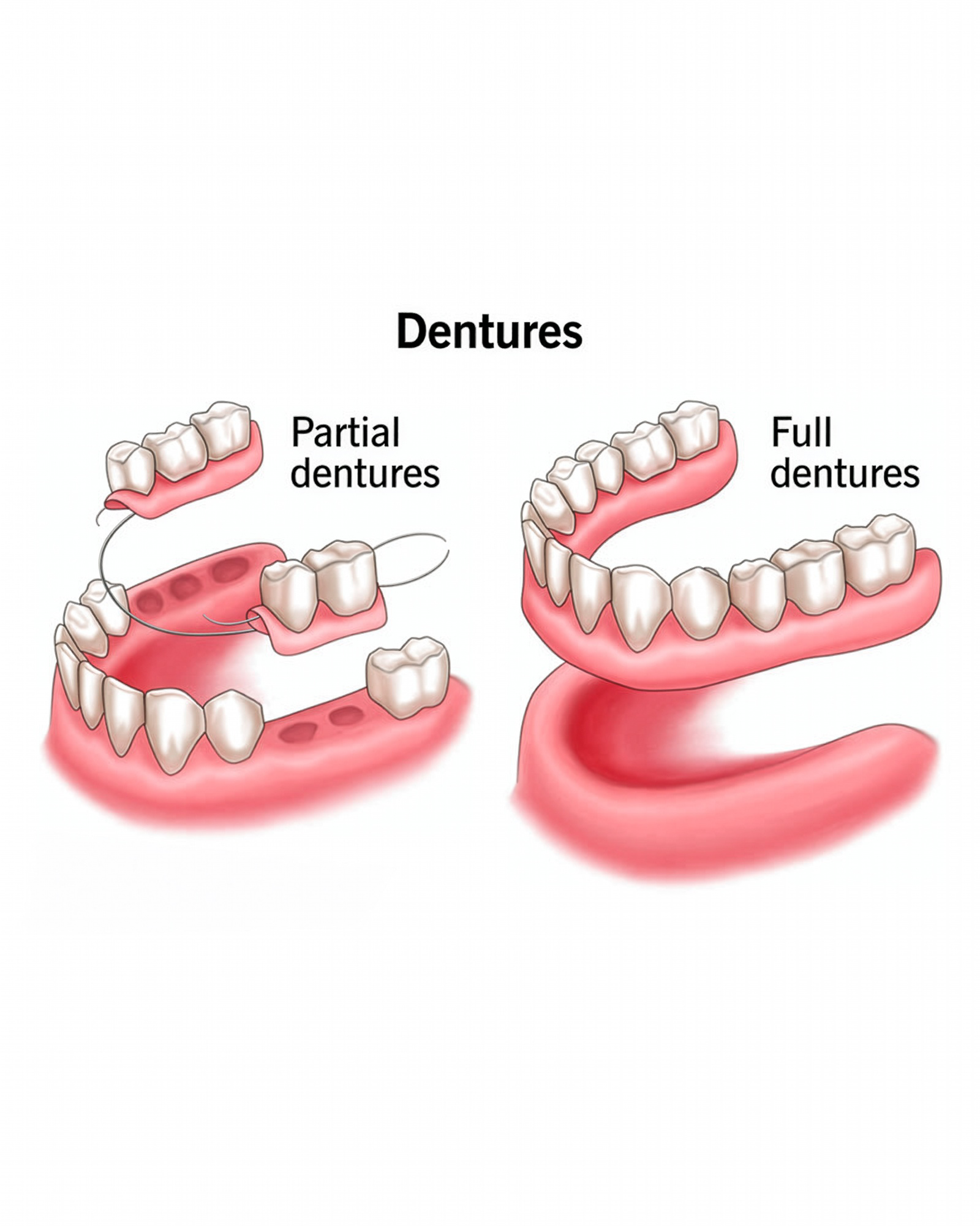 Dentures