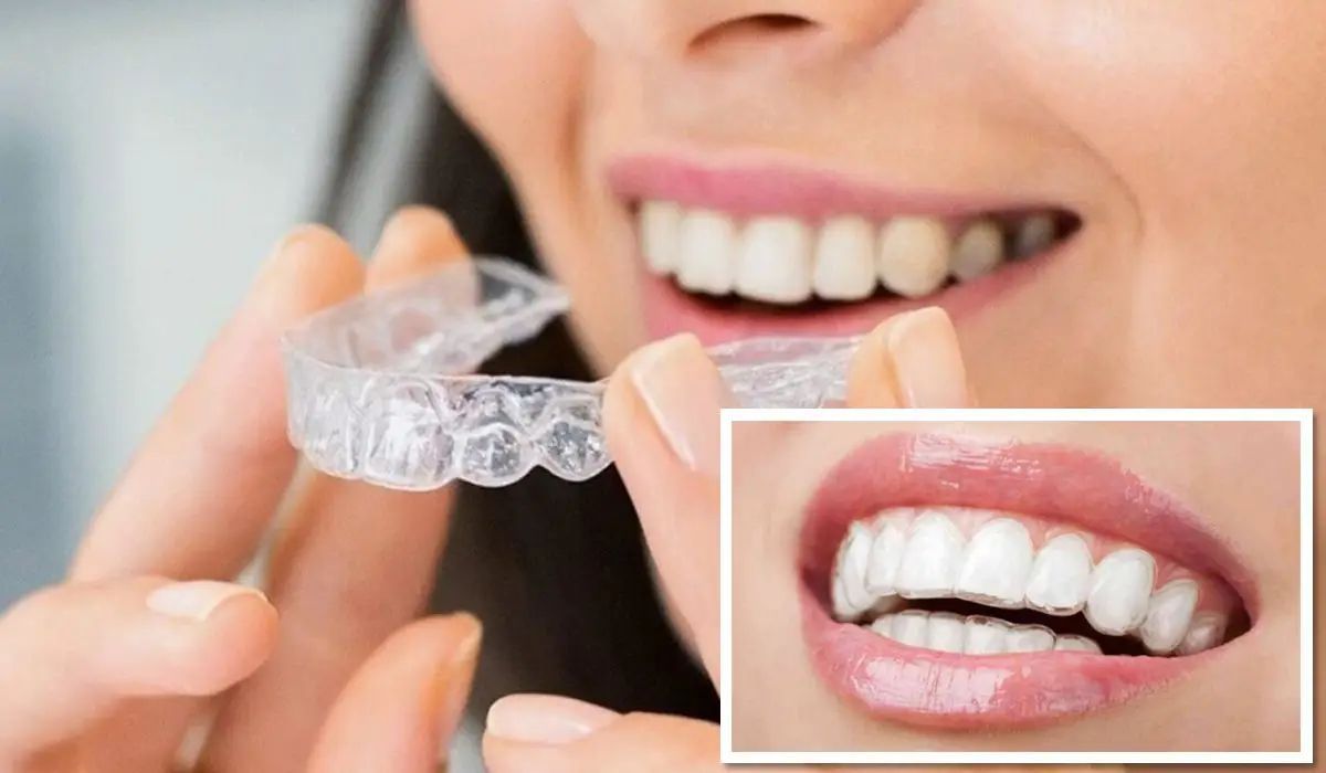 Invisalign treatment at Aurora Dental Care