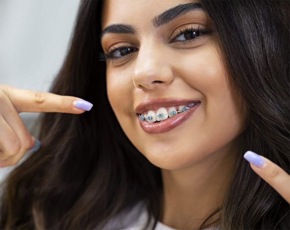 braces and Invisalign in Seattle, WA